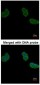 ACY1 / Aminoacylase 1 Antibody